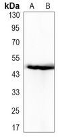 PAI1 Rabbit Monoclonal Antibody