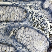 Anti-NRF1 Antibody