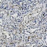 Anti-Moesin Antibody