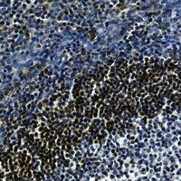 Anti-LTA4H Antibody