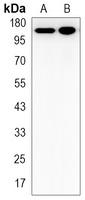 JAK2 Rabbit Monoclonal Antibody