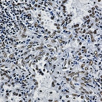 Anti-ILF3 Antibody