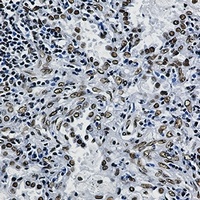 ILF3 antibody