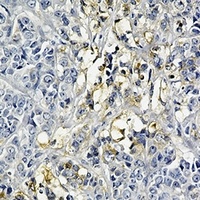 Anti-Hexokinase 2 Antibody