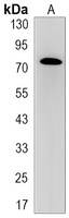 GRP78 Rabbit Monoclonal Antibody