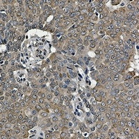 GRP78 Rabbit Monoclonal Antibody