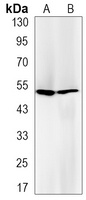 Glutathione Reductase Rabbit Monoclonal Antibody