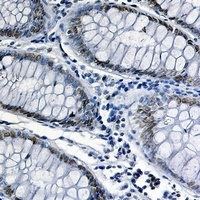 Anti-FUBP1 Antibody