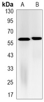 FTO Antibody