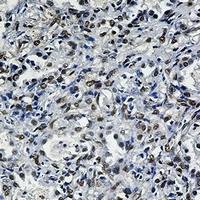 Anti-FTO Antibody