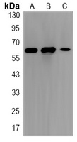 FOXO4 Rabbit Monoclonal Antibody
