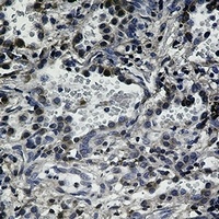 CD95 Antibody