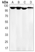 Focal Adhesion Kinase Rabbit Monoclonal Antibody