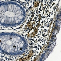 Anti-Focal Adhesion Kinase Antibody