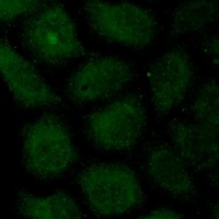 Anti-Focal Adhesion Kinase Antibody