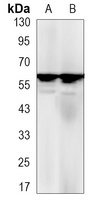 Estrogen Receptor alpha Antibody