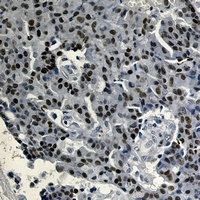 Anti-Estrogen Receptor alpha Antibody