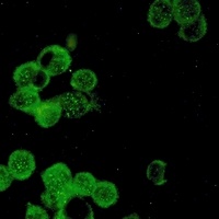 Anti-Estrogen Receptor alpha Antibody