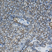 CD326 antibody