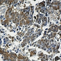 4EBP1 Antibody