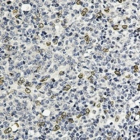 E2F1 Antibody