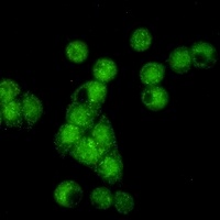 Anti-Cyclin E2 Antibody