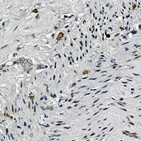 Anti-CREB (Phospho-S133) Antibody