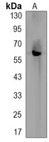 CHK2 Rabbit Monoclonal Antibody
