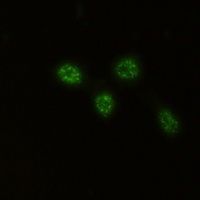 CHK2 Rabbit Monoclonal Antibody