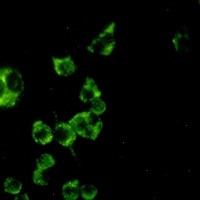 Cathepsin B Antibody