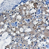 Catalase Antibody
