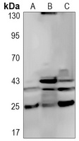 Caspase 4 Rabbit Monoclonal Antibody
