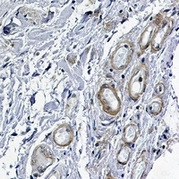 PKA C alpha Rabbit Monoclonal Antibody