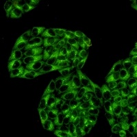 PKA C alpha Rabbit Monoclonal Antibody