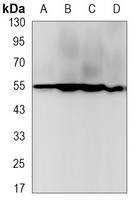 Beta-tubulin Rabbit Monoclonal Antibody