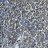 Anti-Beta-tubulin Antibody