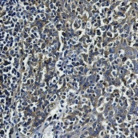 Beta-tubulin antibody