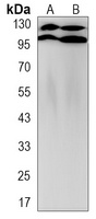 Apolipoprotein E Receptor 2 Rabbit Monoclonal Antibody
