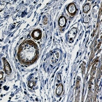 alpha Smooth Muscle Actin Antibody