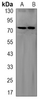 ALPL Antibody