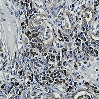 Anti-ALPL Antibody
