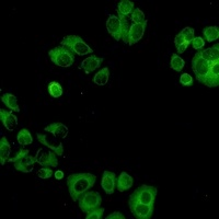 Anti-ALPL Antibody