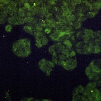 Anti-ADSS Antibody