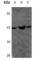 ACADS Rabbit Monoclonal Antibody