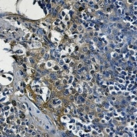 Anti-Alpha-enolase Antibody