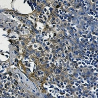 Alpha-enolase antibody