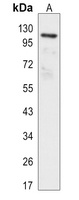 Focal Adhesion Kinase (Phospho-Y397) Antibody