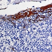 Cytokeratin 10 Rabbit Monoclonal Antibody