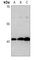 TGF beta 1 Rabbit Monoclonal Antibody