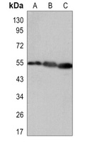 Vimentin Antibody